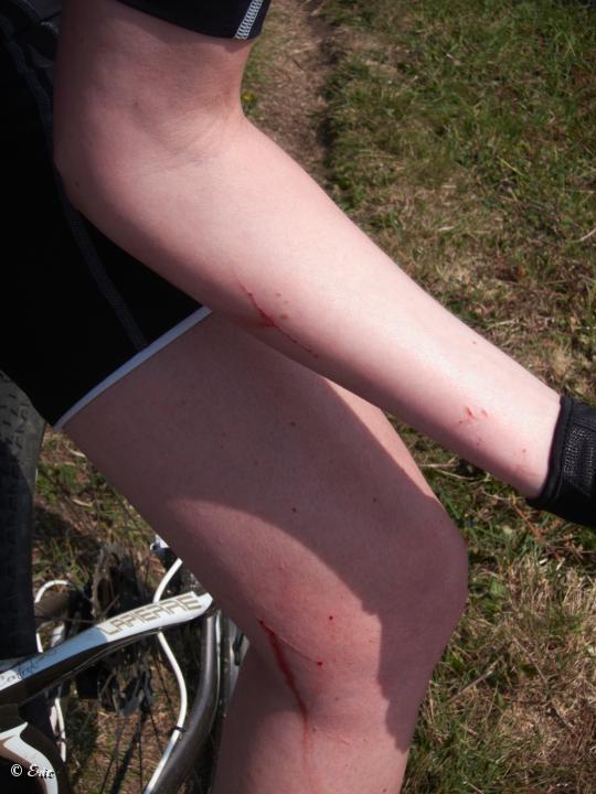 IMG_1003.jpg - Blessures de guerre.